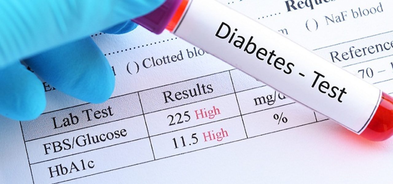Diabetes Screening
